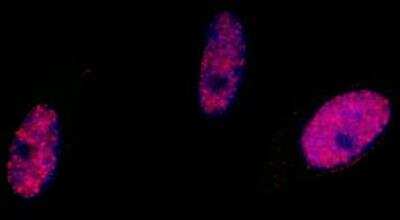 Immunocytochemistry/ Immunofluorescence: SMC1 [p Ser966] Antibody [NB100-206]